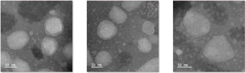 Liposome@PQQ+CY5.5 surface modification YAGKLLISLSEERISAHHVP-FITC/TPP
